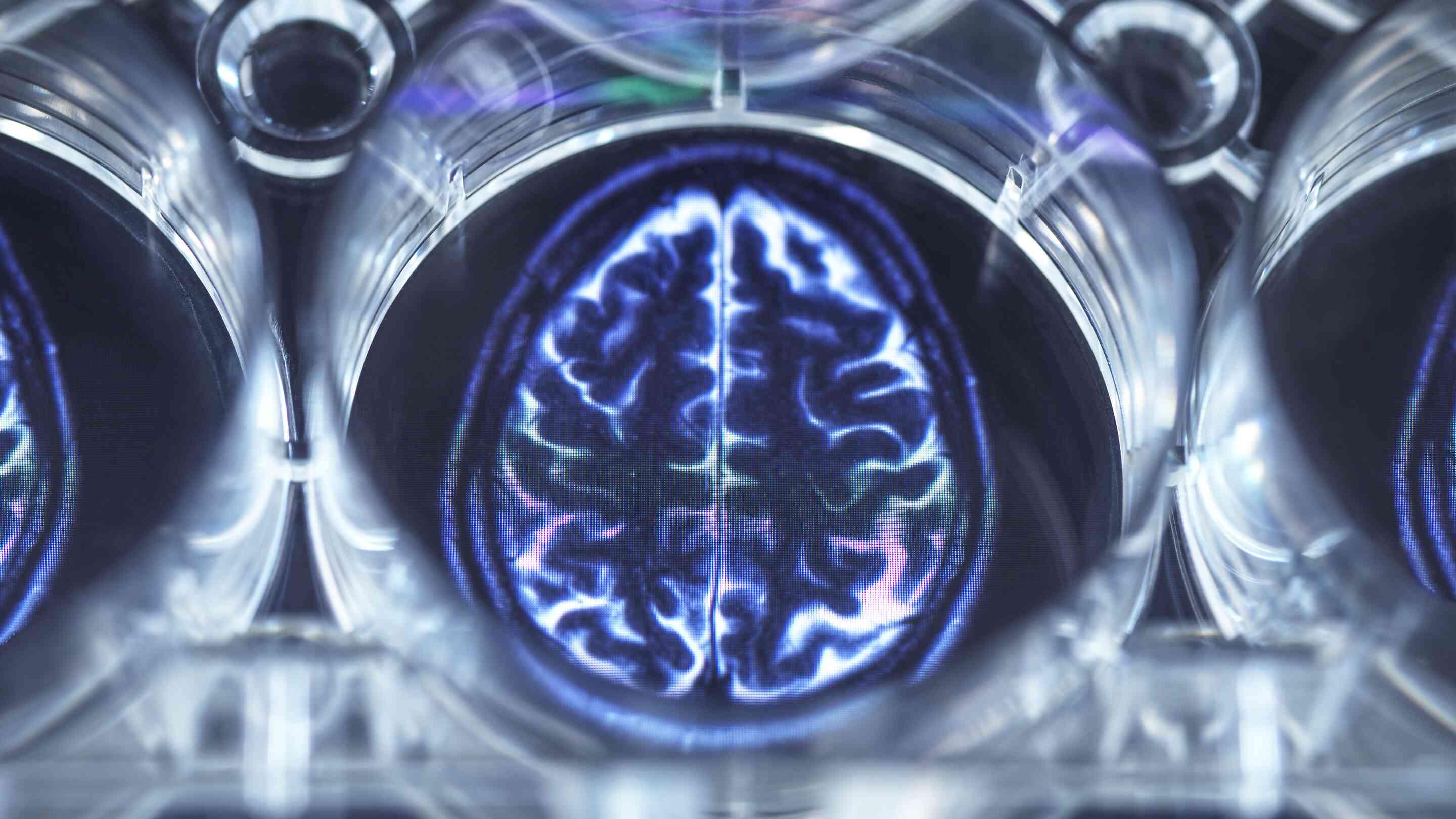 Les neurosciences : l'arme secrète des entreprises performantes !
